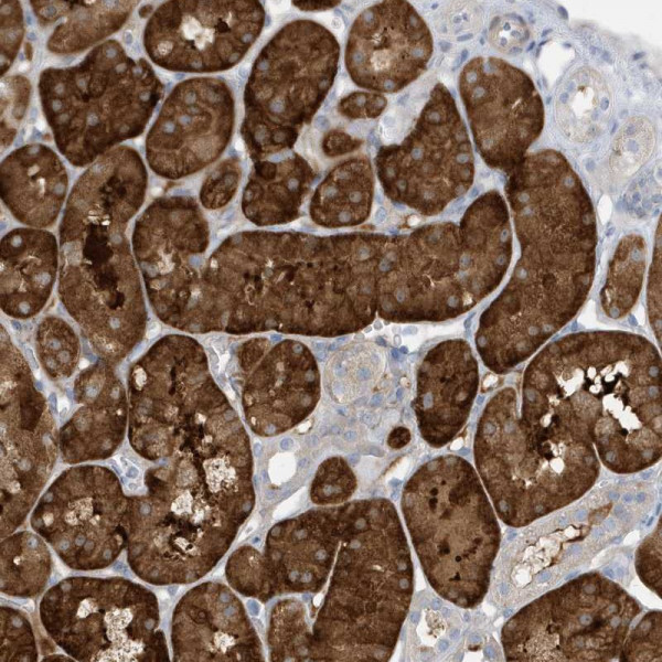 Anti-ATP13A5