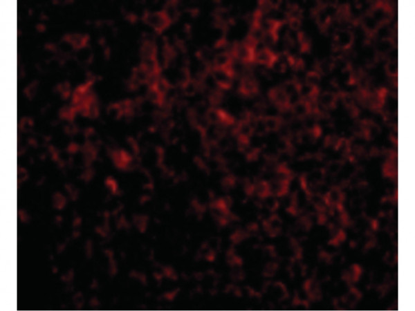 Anti-ATG5