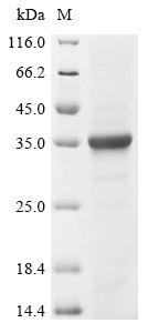 Protein mono-ADP-ribosyltransferase PARP8 (PARP8), partial, recombinant human