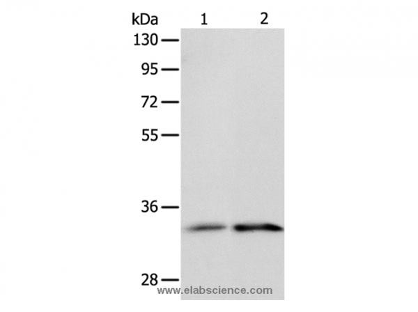 Anti-IL1RL1