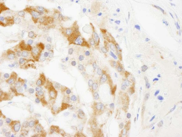 Anti-TRIM3/BERP (IHC)