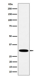 Anti-HMGCL / Hydroxymethylglutaryl CoA lyase, clone 30H50