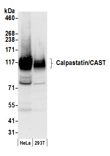 Anti-Calpastatin/CAST