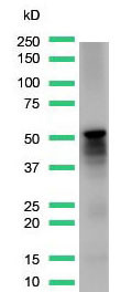 Anti-Desmin, clone SP138