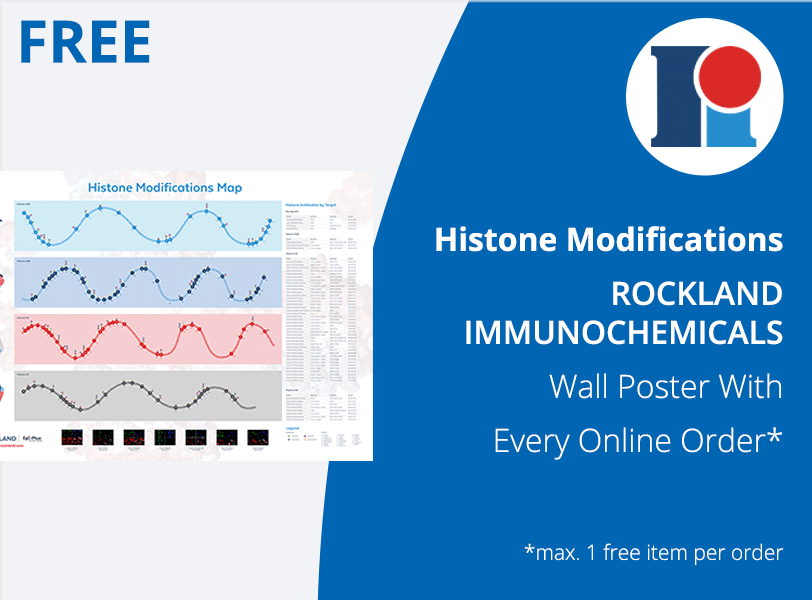 Histone Modifications Poster