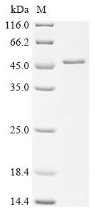Major capsid protein VP1, JC polyomavirus, recombinant