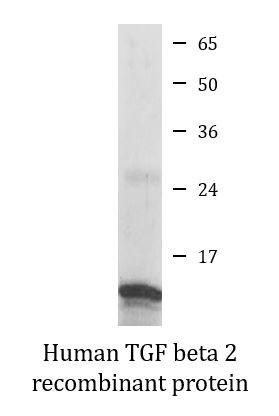 Human TGF beta 2 recombinant protein (Active)