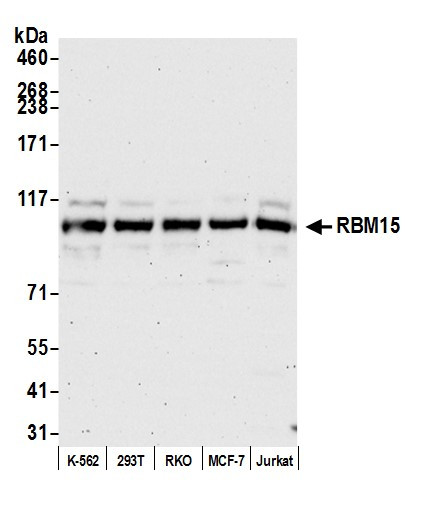 Anti-RBM15