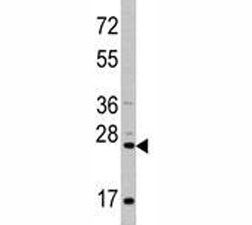 Anti-CD8A