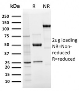 Anti-Langerin / CD207, clone LGRN/3136R