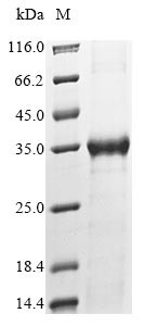 Myosin light chain kinase, smooth muscle (MYLK), partial, human, recombinant