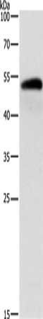Anti-ALDH1B1