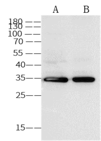 Anti-Annexin V/ANXA5 Monoclonal Antibody