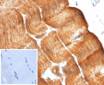 Anti-Sarcomeric Actinin Alpha 2 / ACTN2, recombinant antibody, clone ACTN2/7041R