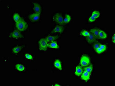 Anti-ATP6V0A2