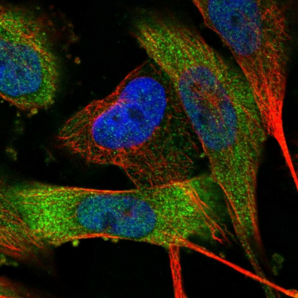 Anti-MPP3
