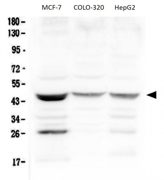 Anti-SFTPB / Prosurfactant Protein B