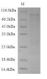 Dipeptidyl peptidase 4 (Dpp4), partial, mouse, recombinant