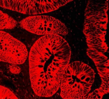 Anti-Cytokeratin 18, clone CY-90