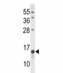Anti-Osteocalcin