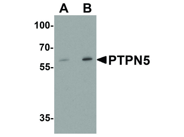Anti-PTPN5