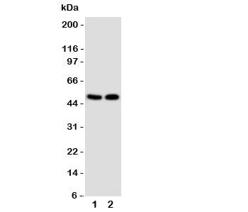 Anti-VDR (Vitamin D Receptor)