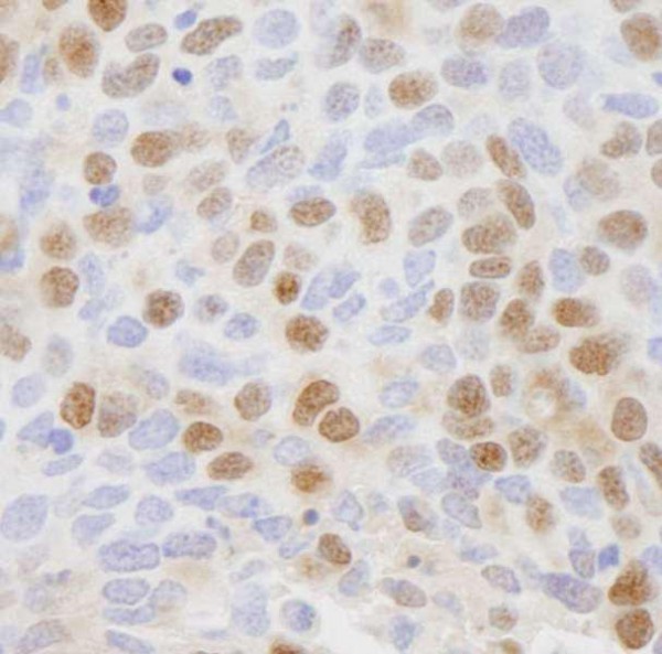 Anti-CSE1 (IHC)
