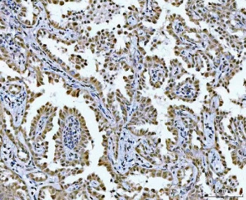 Anti-GLIS1 / GLI-similar 1