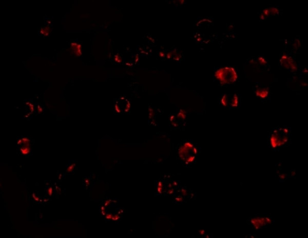Anti-MATN3 / Matrilin 3