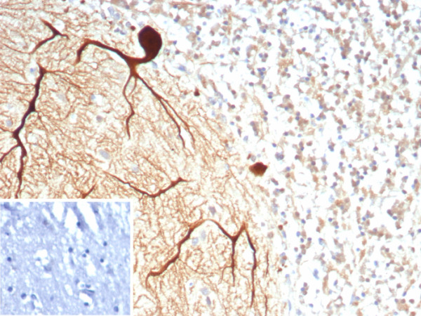 Anti-Carbonic Anhydrase VIII, recombinant antibody, clone CA8/8605R