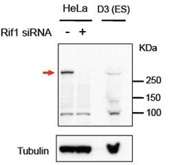 Anti-RIF1