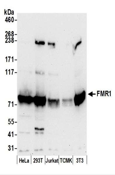 Anti-FMR1/FMRP