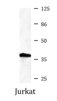Anti-NPM1, clone 2D9-C3-E5