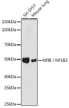 Anti-NFIB / NF1B2