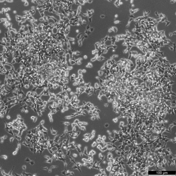 SK-N-LO Cells