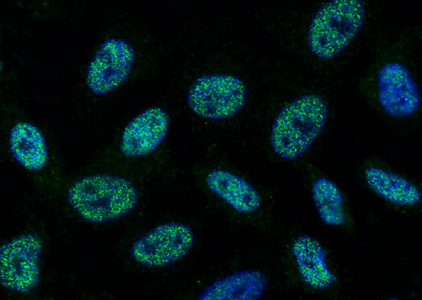 Anti-SAE1 Monoclonal Antibody