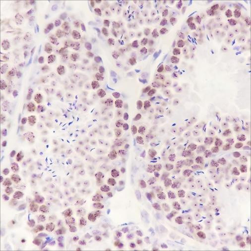 Anti-Recombinant HMGA1, clone A442