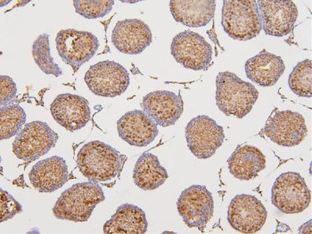 Anti-DAZAP1 / DAZ-associated protein 1