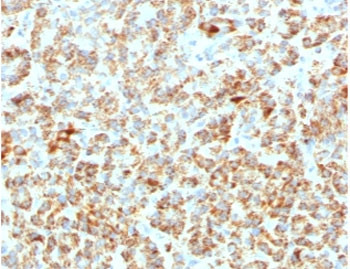 Anti-Frataxin / FXN, clone FDAX-1