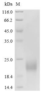 Nucleoprotein (N), recombinant Porcine reproductive and respiratory syndrome virus