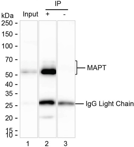 Anti-Tau (S262)