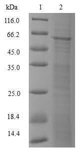 DNA-directed DNA/RNA polymerase mu (POLM), human, recombinant