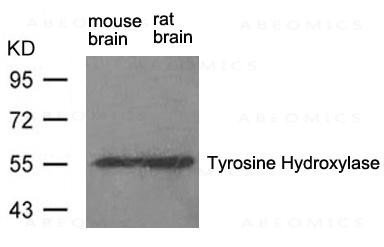 Anti-Tyrosine Hydroxylase (Ab-31)
