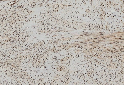Anti-phospho-PERK (Thr981)