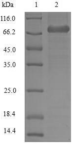 Plastin-2 (LCP1), human, recombinant