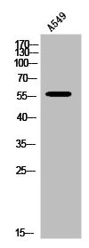 Anti-LIPC