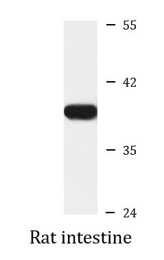 Anti-OTC / Ornithine Carbamoyltransferase