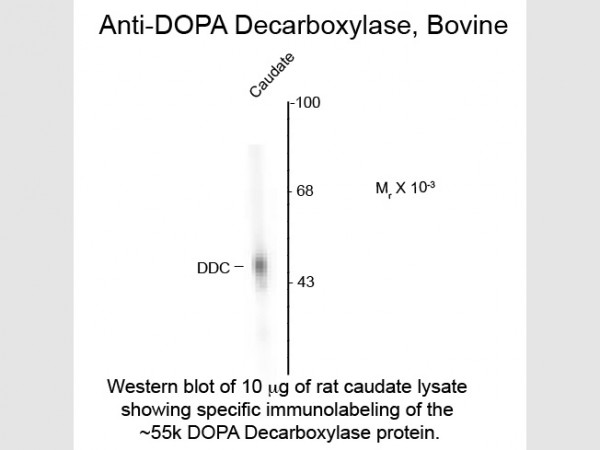 Anti-DOPA Decarboxylase