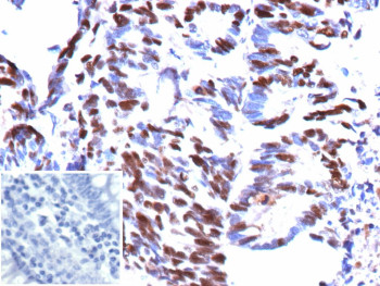 Anti-MCM5 / DNA replication licensing factor MCM5, clone rMCM5/13646