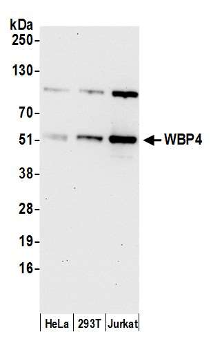 Anti-WBP4